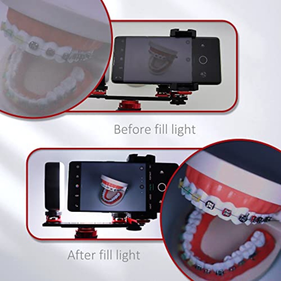 Bluetooth Dental Flash Light P - Photography Lighting Flash recensie en prijs