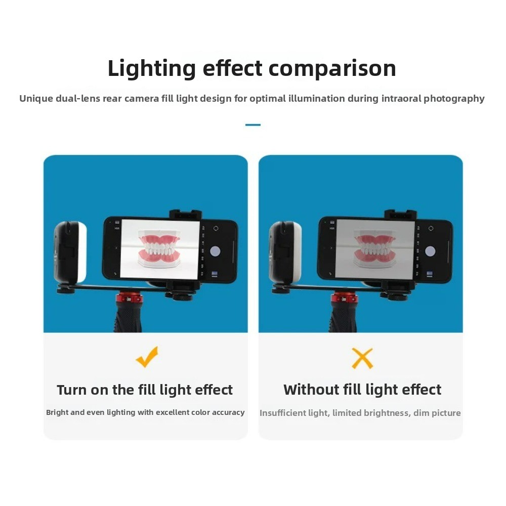 Dental Photography Light, Blue - Photography Lighting Flash recensie en prijs