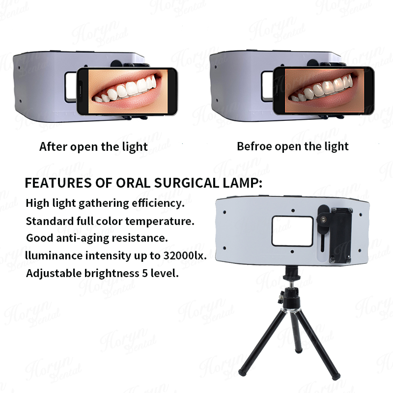 Dental Flash Light Photography - Photography Lighting Flash recensie en prijs
